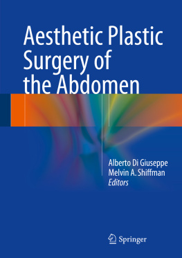 Alberto Di Giuseppe Aesthetic Plastic Surgery of the Abdomen