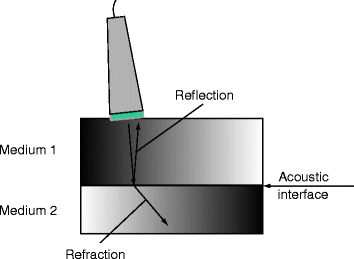 Fig 13 Interactions with tissue As a sound wave strikes a difference in the - photo 3