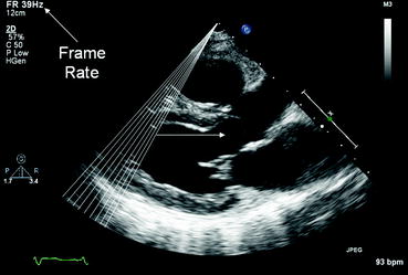 Fig 17 Frame rate An ultrasound image is created one scan line at a time - photo 7