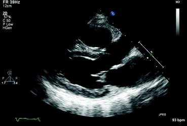 Fig 19 2D Echocardiography 2D echocardiography is a 2D depiction of the - photo 9