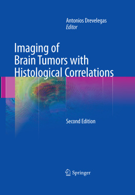 Antonios Drevelegas - Imaging of Brain Tumors with Histological Correlations