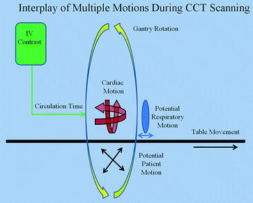 Fig 11 The multiple motions during cardiac CT acquisition Red signifies the - photo 1