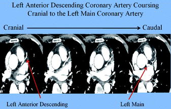 Fig 12 Serial axial slices from cranial left to caudal right - photo 2