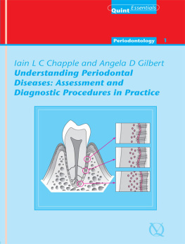 Chapple Iain Understanding Periodontal Diseases: QuintEssentials of Dental Practice Vol. 1