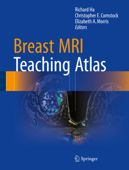 Comstock Christopher E. - Breast MRI Teaching Atlas