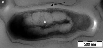 Image 11 Transmission electron microscope image of Mycobacterium tuberculosis - photo 2