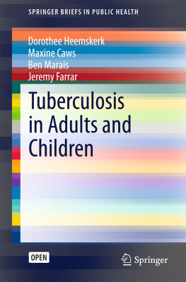 Dorothee Heemskerk Maxine Caws Ben Marais Tuberculosis in Adults and Children