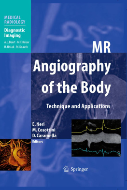 E. Neri M. Cosottini - MR Angiography of the Body