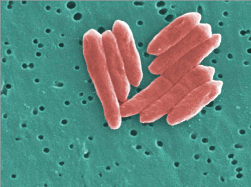 Cells are either eukaryotic or prokaryotic Bacteria including the Sebaldella - photo 3