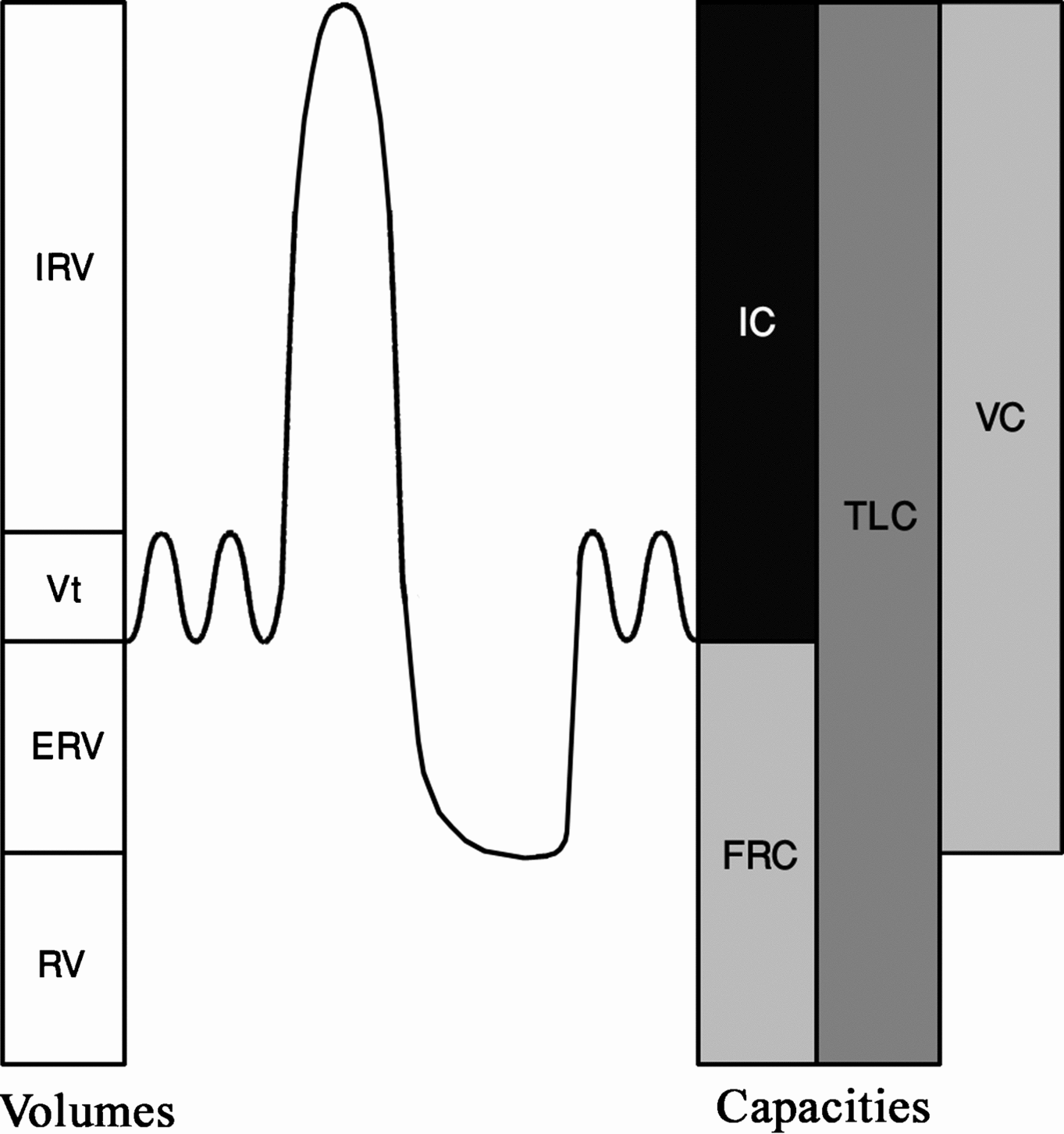 Figure 11 FVC and SVC are compared with each other in a normal subject a - photo 1