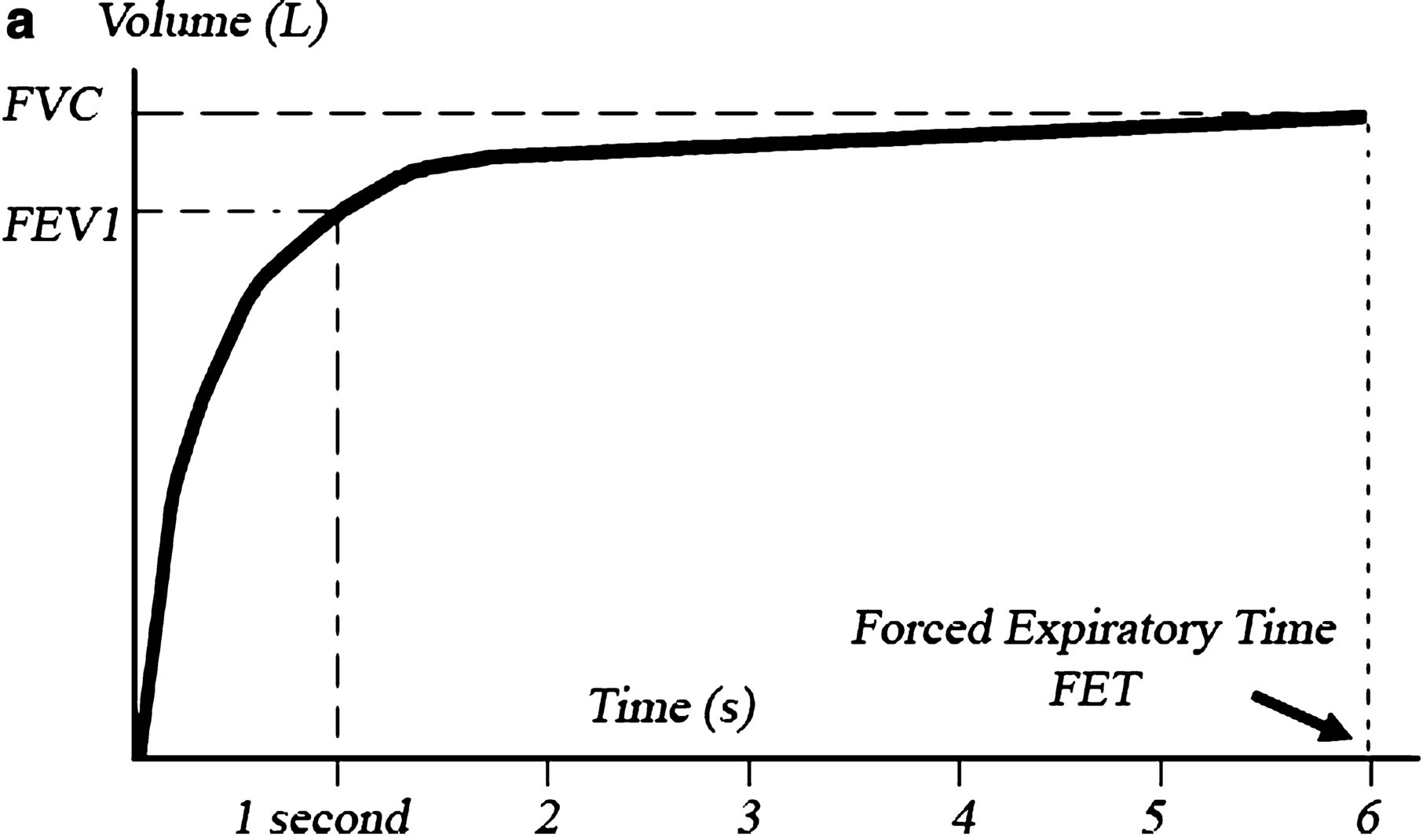 Figure 12 The volumetime curve spirogram The following data can be - photo 3