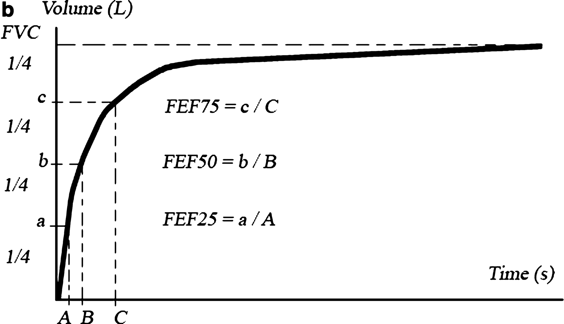 Figure 12 The volumetime curve spirogram The following data can be - photo 4