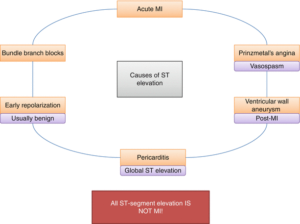 Arteries and Affected Areas Anterior MI Cen - photo 14