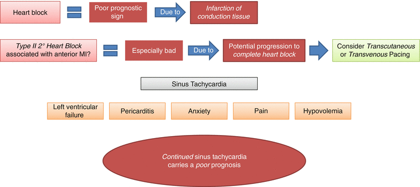 The EKG and Emergent Reperfusion Sgarbossa Criteria - photo 20