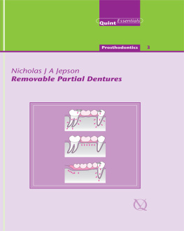 Allen P. Finbarr - Removable Partial Dentures