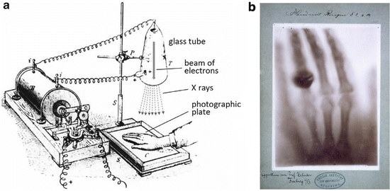 Fig 11 a Apparatus used to make the first radiograph in history on 22 - photo 2