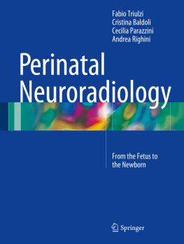 Baldoli Cristina Perinatal neuroradiology: from the fetus to the newborn