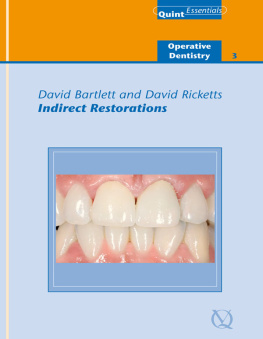 Bartlett David - Indirect Restorations: Quintessentials of Dental Practice Vol. 25