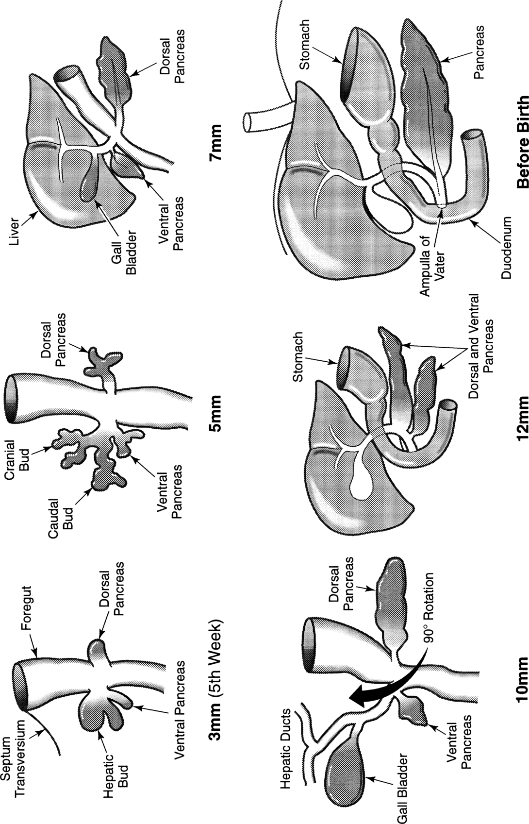 Fig 111 Embryology of the hepatobiliary system The hepatic bud arises from - photo 1