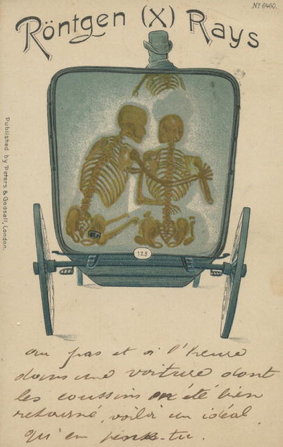 Fig 13 Rntgen X rays The x-rays show the couple in the taxi as skeletons - photo 3