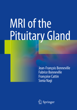 Bonneville Fabrice - MRI of the Pituitary Gland