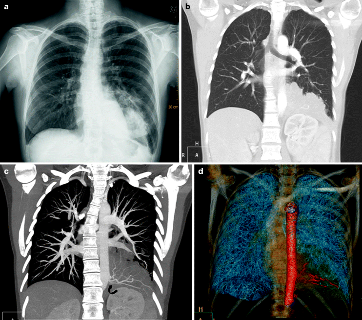 Fig 11 Images obtained from a 35-year-old woman referred for chronic cough - photo 1