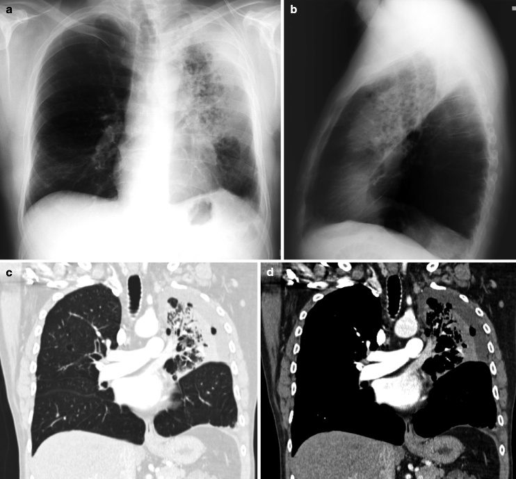 Fig 14 Images obtained from a 65-year-old man who was admitted for fever and - photo 6