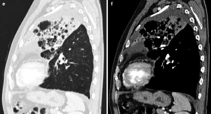 Fig 14 Images obtained from a 65-year-old man who was admitted for fever and - photo 7