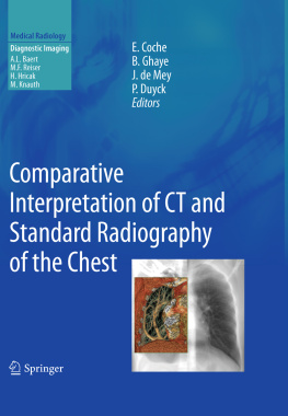 Coche Emmanuel E. - Comparative Interpretation of CT and Standard Radiography of the Chest