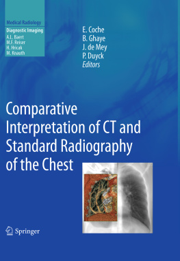 Coche Emmanuel E. Comparative Interpretation of CT and Standard Radiography of the Chest