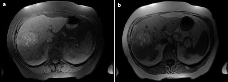 Image 3 Questions What are the findings on US What does the MDCT show - photo 9