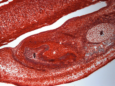 Fig 1 Tricromical stained picture of a rat head at the 14 days of intrauterine - photo 1