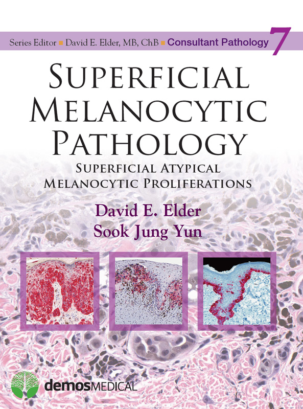 CONSULTANT PATHOLOGY SUPERFICIAL MELANOCYTIC PATHOLOGY Consultant Pathology - photo 1