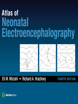 Hrachovy Richard A. MD Atlas of Neonatal Electroencephalography