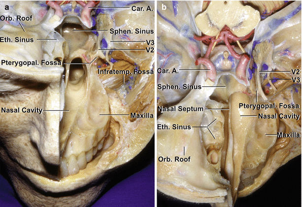 Fig 11 Anterior and middle cranial base a On the left side the floor of - photo 1
