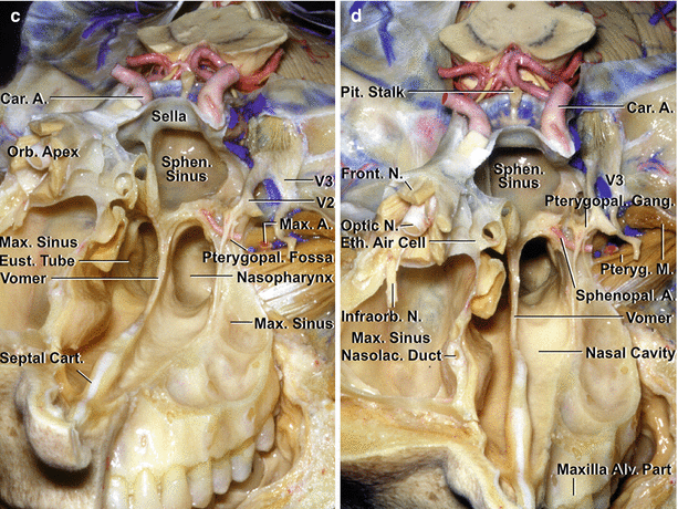 Fig 11 Anterior and middle cranial base a On the left side the floor of - photo 2