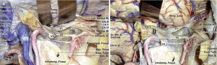 Fig 13 Lateral view of the anterior middle and posterior cranial base a - photo 4