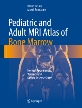 Ilaslan Hakan Pediatric and Adult MRI Atlas of Bone Marrow Normal Appearances, Variants and Diffuse Disease States