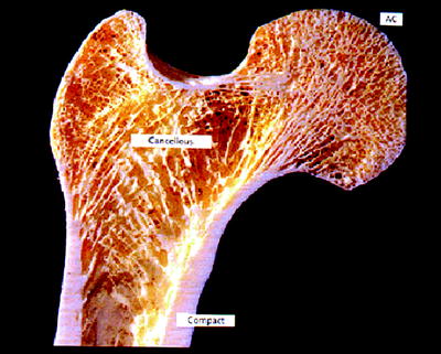 Fig 1 Adult long bone Sagittal section through long bone showing the - photo 1