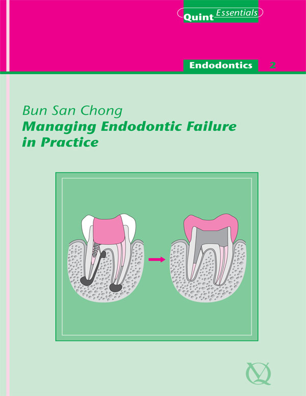 Quintessentials of Dental Practice 23 Endodontics 2 Managing Endodontic - photo 1