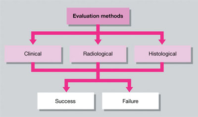 Fig 1-1 Methods of evaluating treatment outcome Clinical Evaluation The - photo 3