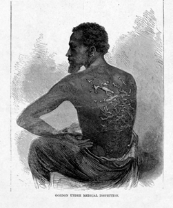 A whipped slave 1863 Illustration from Harpers Weekly The slave was - photo 4