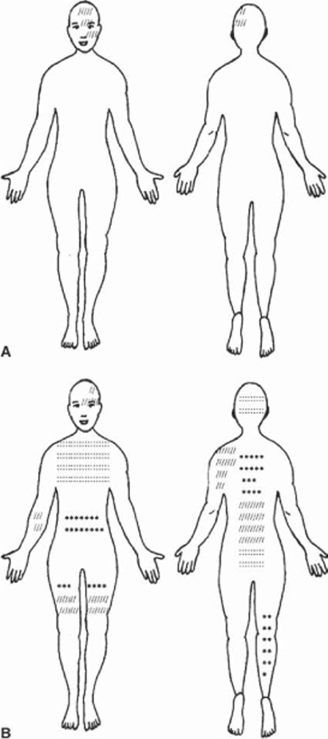 Fig 16 Chief complaints with sample pain drawings A episodic - photo 6