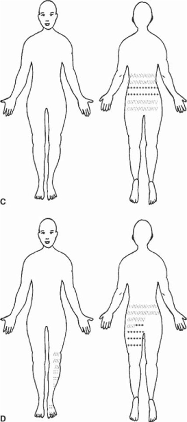 Fig 16 Chief complaints with sample pain drawings A episodic - photo 7