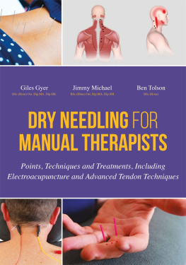 Gyer Giles - Dry Needling for Manual Therapists