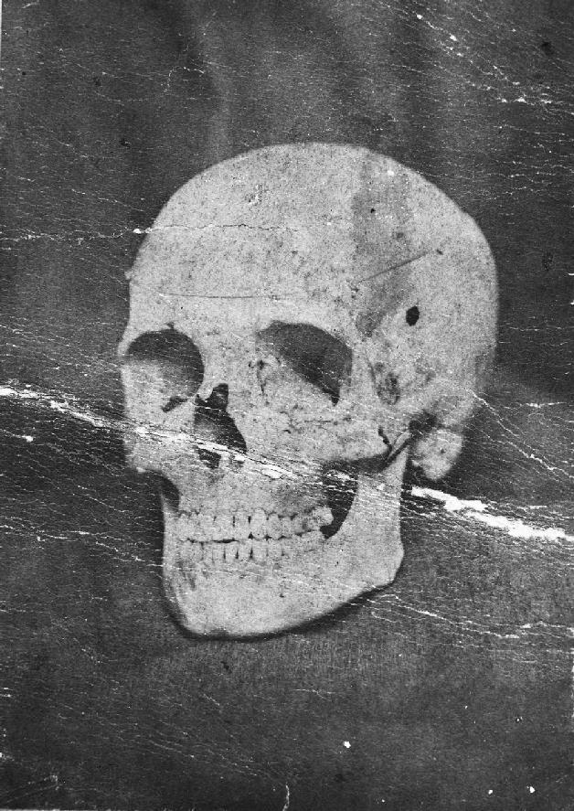 FIG 4 The skull of the adult victim with the entrance wound visible to the - photo 3