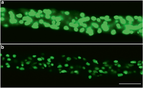 Fig 11 Comparison of a a wide-field epifluorescence and b a confocal - photo 1