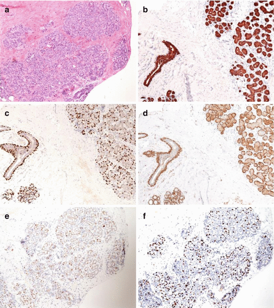 Fig 11 Normal breast tissue The terminal duct lobular unit TDLU is - photo 1