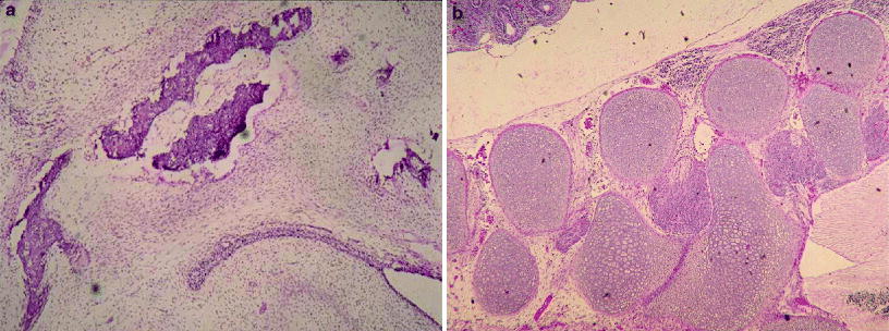 Fig 11 a and b Bone is calcified The crystal structure of calcium - photo 1