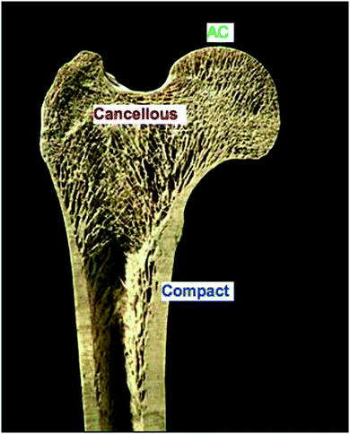 Fig 12 Adult long bone Sagittal section through the proximal femur showing - photo 2